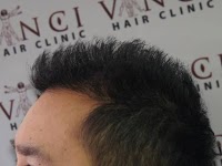 Vinci Hair Clinic 380136 Image 4